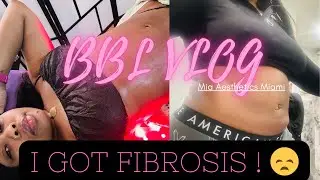 BBL VLOG | Mia Aesthetics Miami | 8-Weeks Post Op | I Got FIBROSIS 😤 I'm so Annoyed !! |