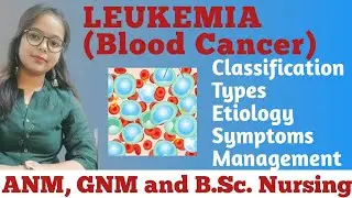 Leukemia | Types of Leukemia | Classification | Symptoms | Management and Treatment |