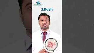 Crack the Chicken Pox Code with Dr. Vishrut Singh! 🐔✨ #felixhospital