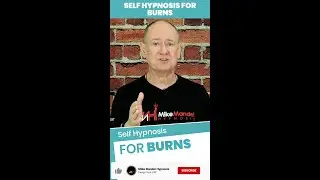 Self Hypnosis for Burns