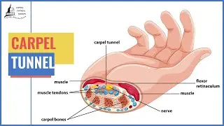 Physical Therapy Treatments For Carpal Tunnel Syndrome | Capitol Physical Therapy | Washington DC