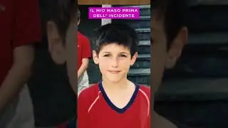 Prima del setto nasale deviato 😊