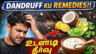 Dandruff  Home remedies|5 easy natural tips |tamil @newjourneyatbangalore2026#dandruff #youtube 