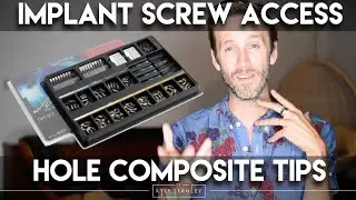 Implant Crown Screw Access Hole Composite -Dr. Kyle Stanley