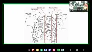 Dinding Thorax, Pleura, dan Pulmo, Mediastinum , Pericardium, dan Cor
