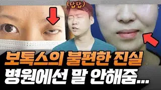 병원에서는 말 안해주는 보톡스의 치명적 단점 l feat.보톡스 주의사항, 부작용