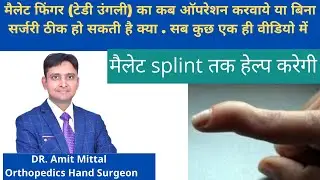 Mallet Finger Treatment In Hindi | मैलेट फिंगर की कब सर्जरी करवाये |Everything about mallet finger