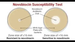 Novobiocin Susceptibility Test laboratory method used to identify coagulase negative staphylococci