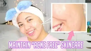 Basic B*tch Skincare Routine for ACNE PRONE OILY SKIN!