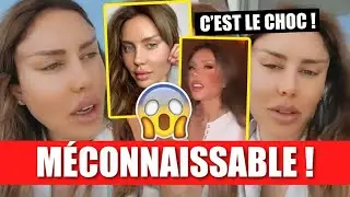 HANEIA M&Eacute;CONNAISSABLE APR&Egrave;S SON OP&Eacute;RATION... 😱 C&rsquo;EST LE CHOC !! ELLE D&Eacute;CIDE DE TOUT EXPLIQUER !