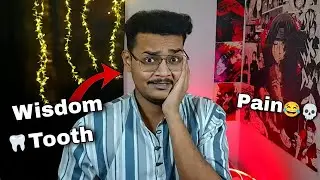 Wisdom Tooth Ne Career Khatam Kar Diya 😂 (Painfull Roast)