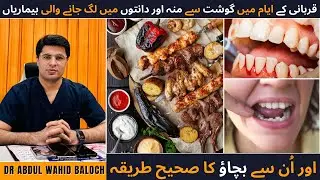 Diseases of Mouth & Teeth from Meat during The Days of Eid ul Adha - Eid ul Adha or Danton Main Dard