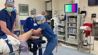 Hip Manipulation Under Anesthesia for Post Hip Arthroscopy Pericapsular Scarring