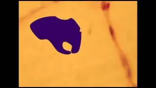 IMMUNE SYSTEM: ANTIGEN PRESENTING CELLS