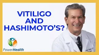 Vitiligo and Hashimoto's