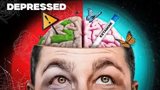 This Is Your Brain on Ketamine: What REALLY Happens