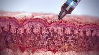 The Sculptra Advantage