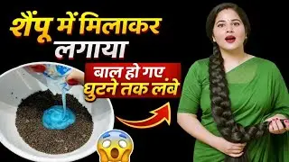 शैंपू में यह मिलाकर लगाया | बाल हो गए घुटने तक लंबे 😱 | Hair Growth Remedy