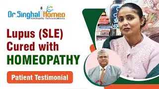 Lupus (SLE) Recovery with Homeopathy | Patient Testimonial | Dr. Vikas Singhal #lupustreatment