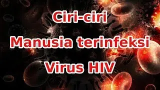 Ciri Orang terinfeksi viru HIV
