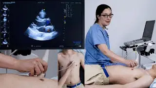 Using Colour Doppler - the PLAX view