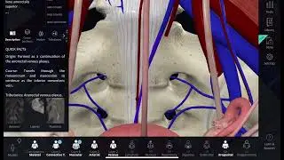Complication of sacrocopoplexy