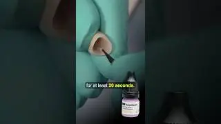 HOW TO Deliver Zirconia Crowns for the ANTERIOR Teeth #dentist