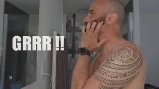 Barbe qui d&eacute;mange, pellicules de barbe....que faire ?