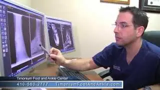 Podiatrst And Board Certified Surgeon To Treat Your Foot And Ankle Needs