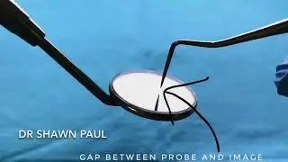 Front Surface Dental Mouth Mirrors, Explained