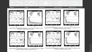 Power Quality Improvements and Design of Filters