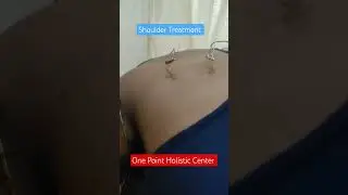 Shoulder Pain Treatment.#health #acupunctureworks #kneepain #shoulderpain