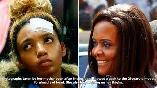 Grace mugabe: zimbabwe's first lady accuses model gabriella engels of knife attack