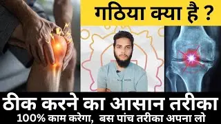 Osteoarthritis 5 Best Tips | गठिया ठीक करने के लिए 5 सबसे अच्छा तरीका | #drshahbaj #osteoarthritis 