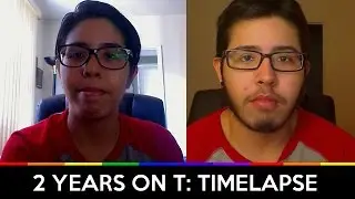 FTM 2 Years on Testosterone: Timelapse