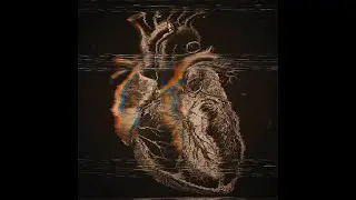 mptt. - arrhythmia