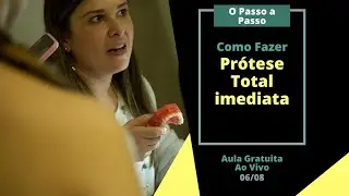 Como Fazer Prótese Total Imediata | Passo a Passo | Live 5k Seguidores
