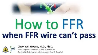 Как использовать FFR, если провод FFR не может пройти