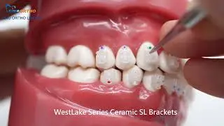 SINO ORTHO Ceramic Self Ligating Brackets