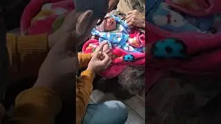How to collect a blood sample of baby#baby #sample