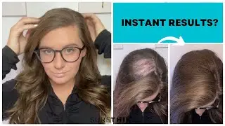 Fill in your Bald Spots Instantly with SureThik Hair Fibers