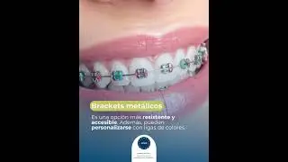 ORTODONCISTAS EN POZUELO DE ALARCON ORTODONCIAS INVISIBLES BRACKETS DENTISTAS CLINICAS DENTALES