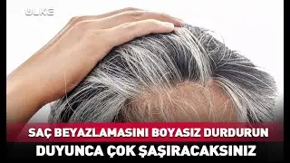 Sa&ccedil; Beyazlamasını Boyasız Durdurun! #haber