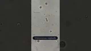 #trichomoniasis #virelshorts #viralvideo