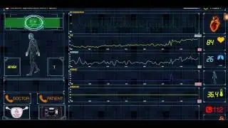 Online holter monitoring