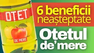 Oțetul de mere: 6 Beneficii Neașteptate