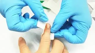 How to Apply Butterfly Stitches