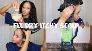 DIY Hair Mask for Dry Hair | GET RID OF Dry, Itchy Scalp