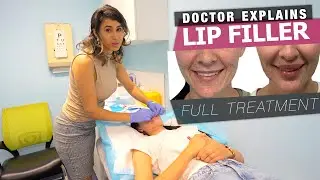 Lip treatments for Thin Upper Lips 💋