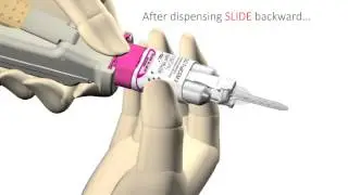GC FujiCEM 2 SLIDE  LOCK